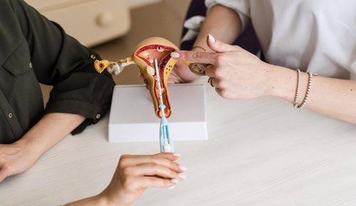 IUI Process & Reproductive Support